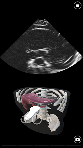 Deepscope Ultrasound Simulator Screen 2
