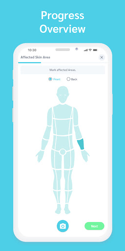 Psoriasis App | Sorea Screen 2