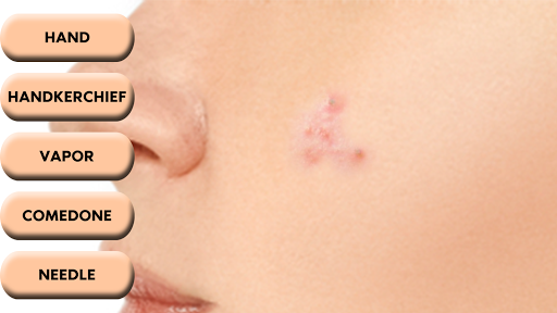 Pimple Popper Screen 3