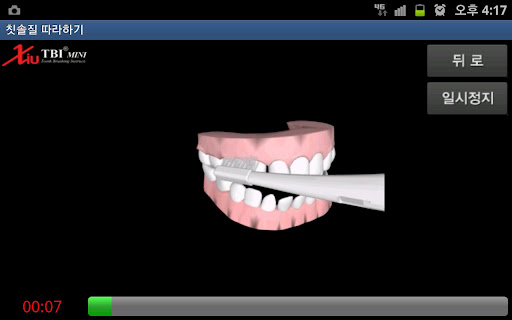 칫솔질 도우미 (변형바스법) Screen 2