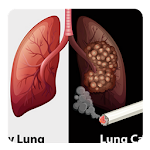 Cover Image of डाउनलोड Lung cancer guide  APK