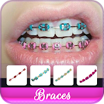 Cover Image of 下载 Braces Colors Beauty  APK