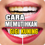 Cover Image of ダウンロード Cara Putihkan Gigi Kuning 2.2.1 APK