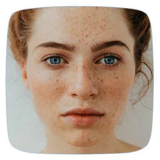 Freckles Home Remedies Tips logo