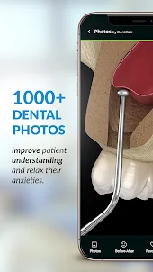 DentiCalc: the dental app