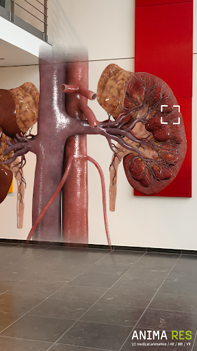 INSIGHT KIDNEY Enterprise Screen 3