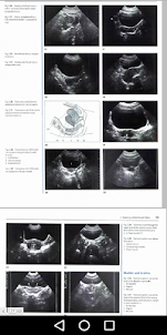 Gynecology - Ultrasound in Obs