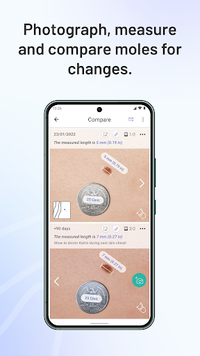 Anteprima dell'app