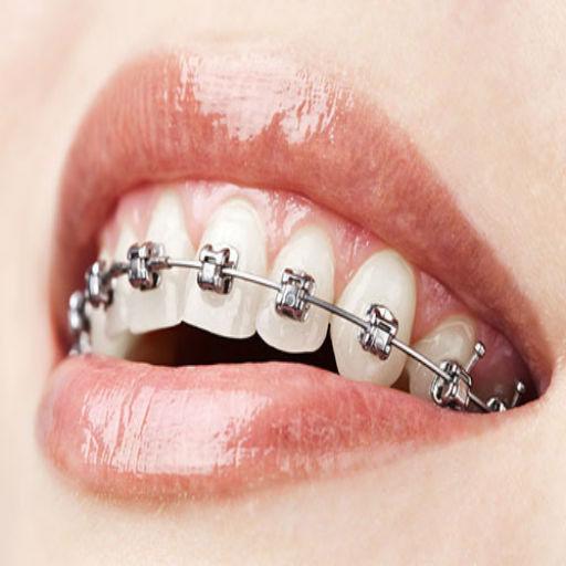 Orthodontic Guide