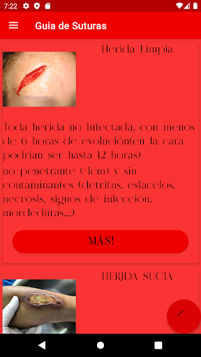 Android application Guia de suturas screenshort