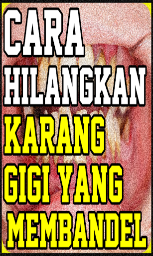 Cara Menghilangkan Karang Gigi