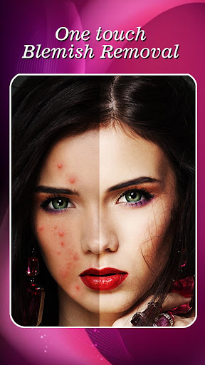 Face Blemishes Removal 1.5 Apk Mod poster-6