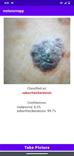 MelanomApp Screen 2