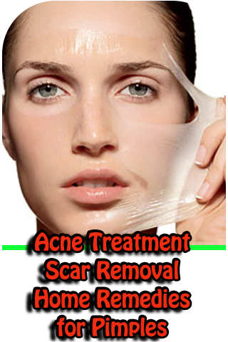 Android application Remedies for Pimples, Acne Tre screenshort