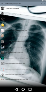 Medical X-Ray Interpretation with 100+ Cases  Screenshots 8