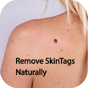 Top 35 Beauty Apps Like Beauty Exercise - Remove SkinTags Naturally - Best Alternatives