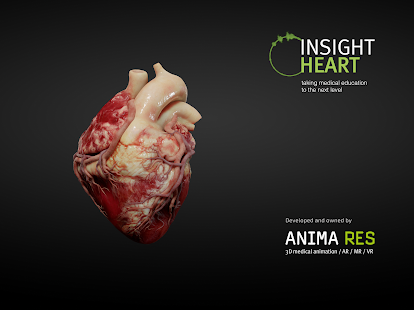 INSIGHT HEART Ekran Görüntüsü