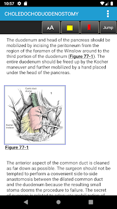 Zollinger Atlas of Surgery 11Eのおすすめ画像5