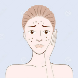 Get Rid of Acne Naturally icon