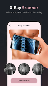 Xray Body Scanner Prank