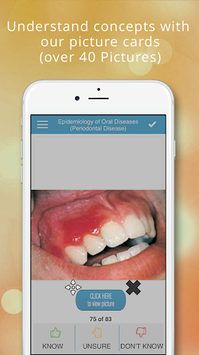NBDE & iNBDE Dental Boards - D Screen 2