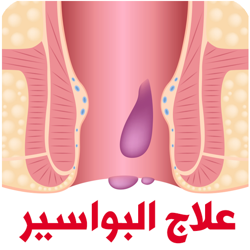 علاج البواسير الداخلية والخارج  Icon