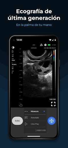 MediExpert - SonoExpert Screen 2