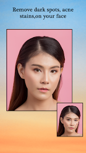 Pimple Remover, Eraser – Face Beauty Maker 5