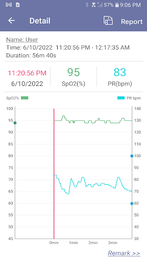 EMAY Bluetooth Pulse Oximeter Screen 3