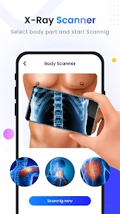 X-Ray Body Part Scanner