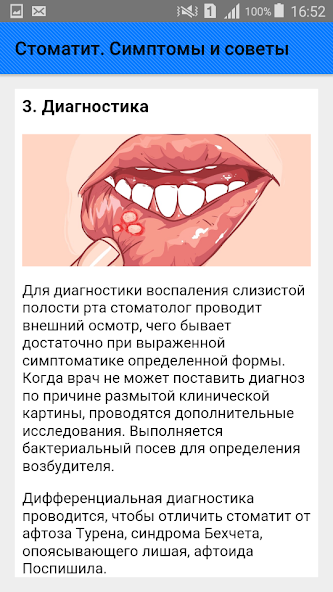 Как выглядит стоматит у человека