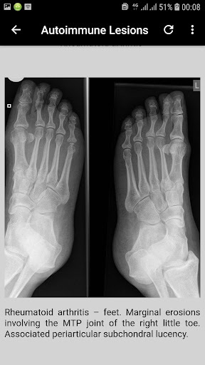 musculoskeletal x-ray interpretation GUIDE