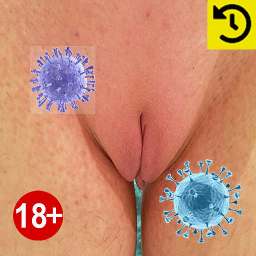 Bacterial vaginosis: Symptoms Download on Windows