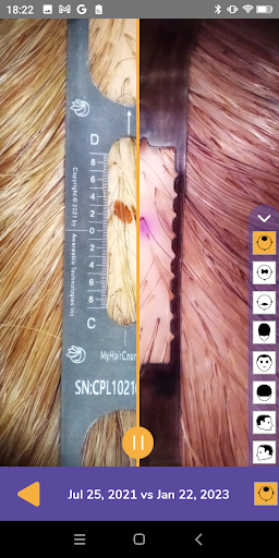 MyHairCounts Screen 3