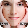 Face Blemish Remover - Smooth  icon