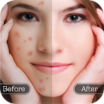 Cover Image of Download Face Blemish Remover - Smooth Skin & Beautify Face 1.7 APK