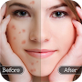 Face Blemish Remover - Smooth 