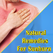 Natural Remedies For Sunburn