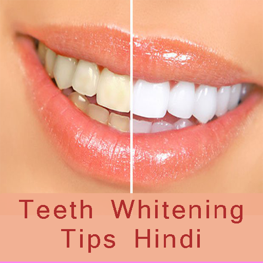 Teeth whitening appleton