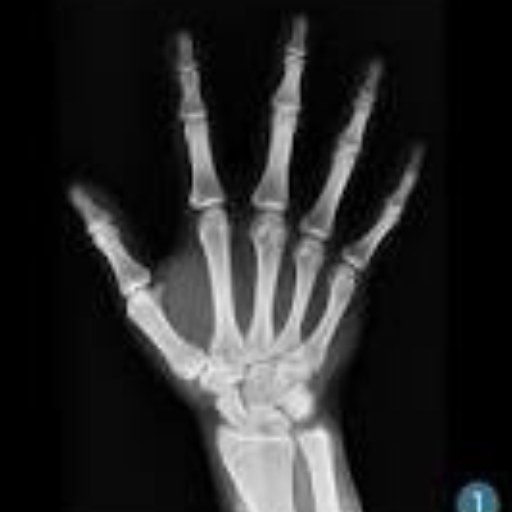 Análisis Carpal logo