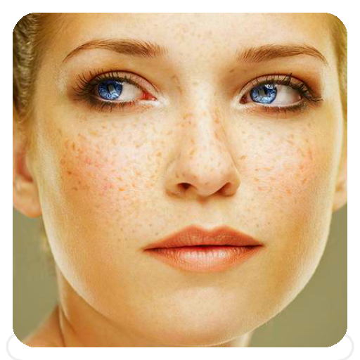 Freckles Tips - Google Play 앱