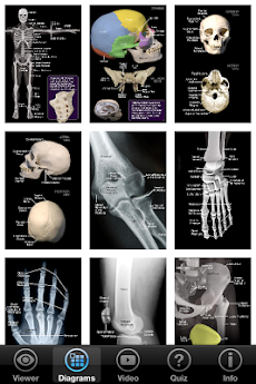 Skeletal Anatomy 3Dのおすすめ画像5