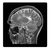 Understanding MRI: Multiple Sclerosis  for PC Windows and Mac