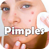 How To Get Rid Of Pimples icon