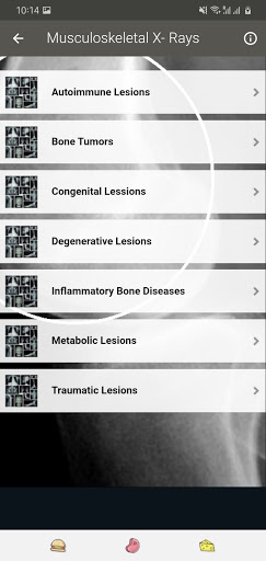 X-RAY Interpretation - cases Screenshot