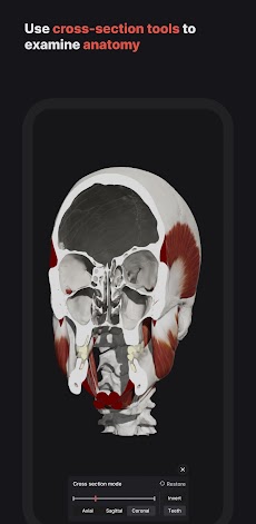 Skull, Teeth & TMJのおすすめ画像5