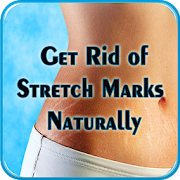 Get Rid of Stretch Marks Naturally