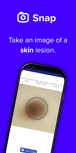 Android application emdee Skin: Cancer & Moles screenshort