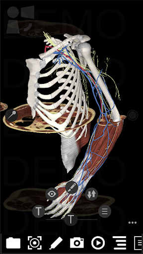3Dissect Upper Limb Screen 2