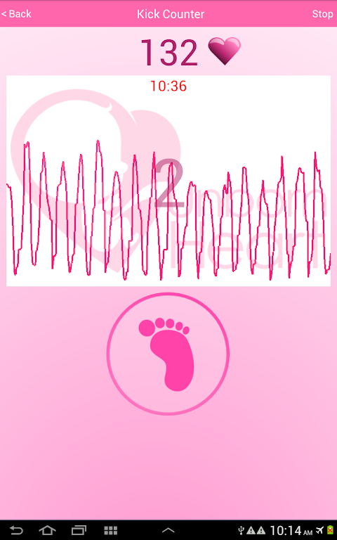 Fetal Doppler UnbornHeartのおすすめ画像5